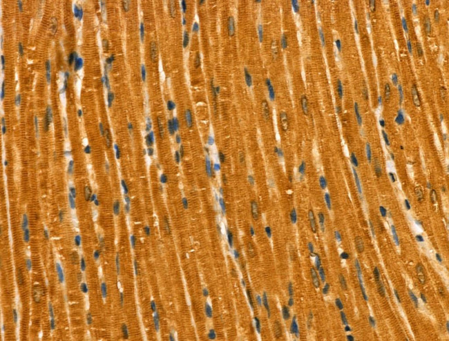 Phospho-RAB29 (Thr71) Antibody in Immunohistochemistry (Paraffin) (IHC (P))