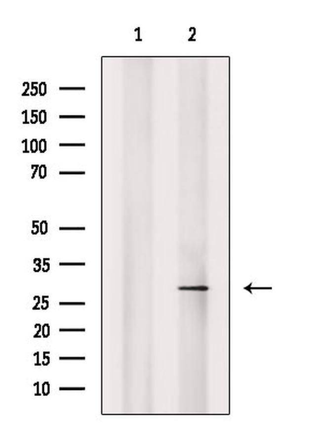 Phospho-RAB29 (Thr71) Antibody in Western Blot (WB)