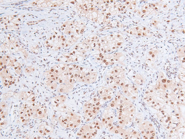 Phospho-RB1 (Ser788) Antibody in Immunohistochemistry (Paraffin) (IHC (P))