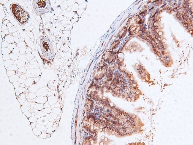 Phospho-RB1 (Ser788) Antibody in Immunohistochemistry (Paraffin) (IHC (P))