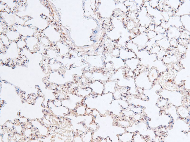 Phospho-RB1 (Ser788) Antibody in Immunohistochemistry (Paraffin) (IHC (P))