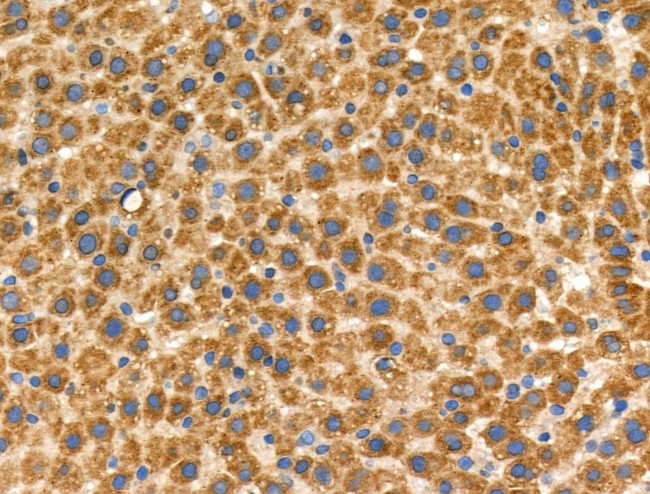 Phospho-ROCK1 (Thr455, Ser456) Antibody in Immunohistochemistry (Paraffin) (IHC (P))