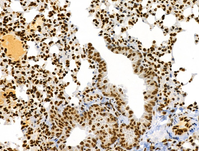 Phospho-RSK Pan (Ser221, Ser227, Ser218, Ser232) Antibody in Immunohistochemistry (Paraffin) (IHC (P))