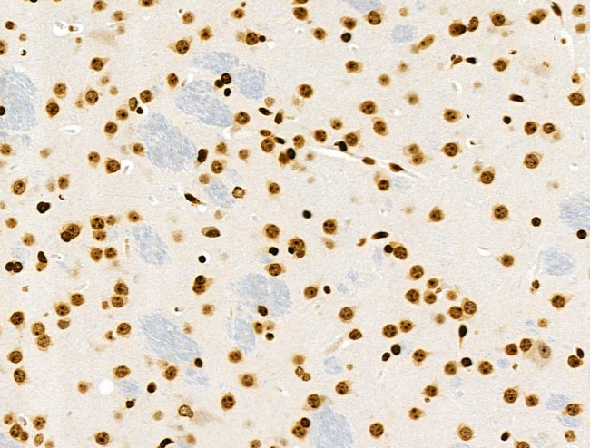 Phospho-RSK Pan (Ser221, Ser227, Ser218, Ser232) Antibody in Immunohistochemistry (Paraffin) (IHC (P))