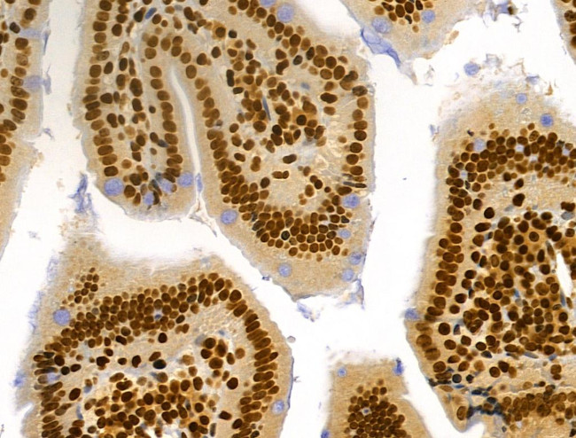 Phospho-RSK Pan (Ser221, Ser227, Ser218, Ser232) Antibody in Immunohistochemistry (Paraffin) (IHC (P))