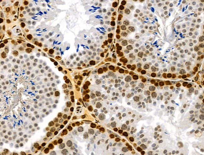 Phospho-RSK Pan (Ser221, Ser227, Ser218, Ser232) Antibody in Immunohistochemistry (Paraffin) (IHC (P))