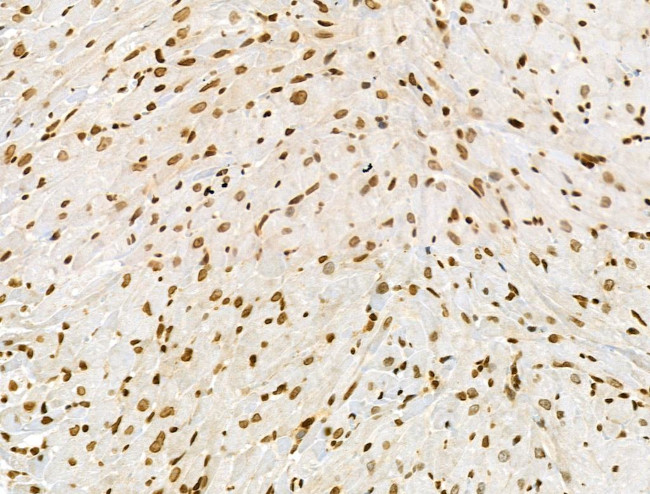 Phospho-RSK Pan (Ser221, Ser227, Ser218, Ser232) Antibody in Immunohistochemistry (Paraffin) (IHC (P))