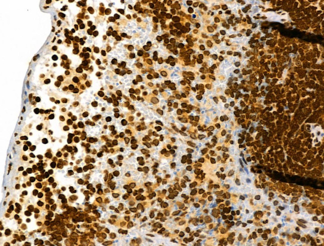 Phospho-RSK Pan (Ser221, Ser227, Ser218, Ser232) Antibody in Immunohistochemistry (Paraffin) (IHC (P))