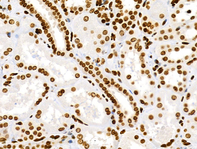 Phospho-RSK Pan (Ser221, Ser227, Ser218, Ser232) Antibody in Immunohistochemistry (Paraffin) (IHC (P))