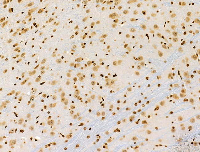 Phospho-RSK Pan (Ser221, Ser227, Ser218, Ser232) Antibody in Immunohistochemistry (Paraffin) (IHC (P))