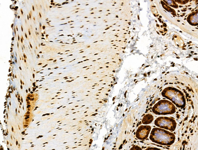 Phospho-RSK Pan (Ser221, Ser227, Ser218, Ser232) Antibody in Immunohistochemistry (Paraffin) (IHC (P))