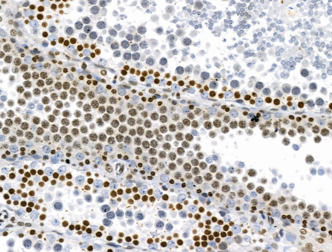 Phospho-RSK Pan (Ser221, Ser227, Ser218, Ser232) Antibody in Immunohistochemistry (Paraffin) (IHC (P))