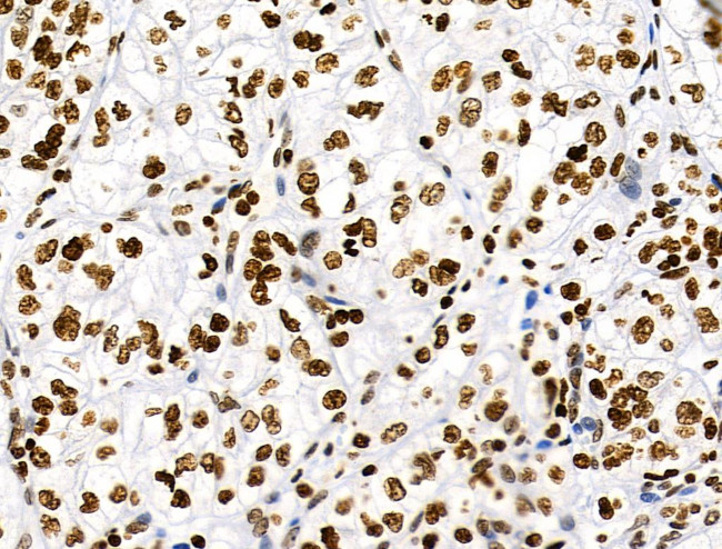 Phospho-RSK Pan (Ser221, Ser227, Ser218, Ser232) Antibody in Immunohistochemistry (Paraffin) (IHC (P))