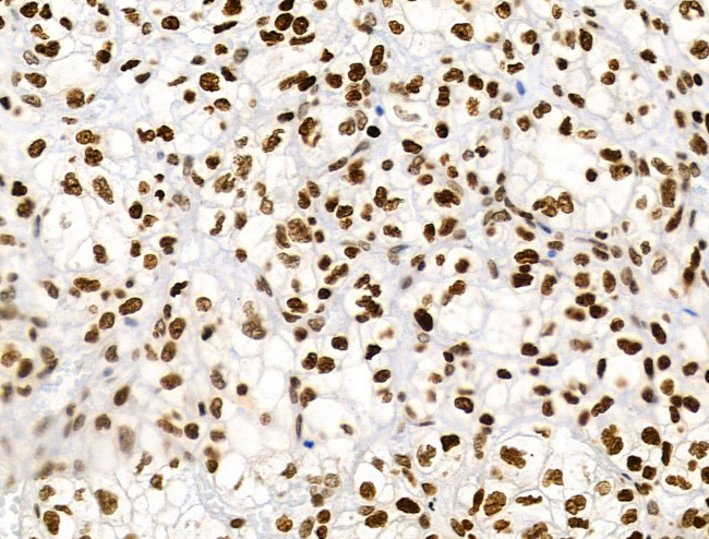 Phospho-RSK Pan (Ser221, Ser227, Ser218, Ser232) Antibody in Immunohistochemistry (Paraffin) (IHC (P))