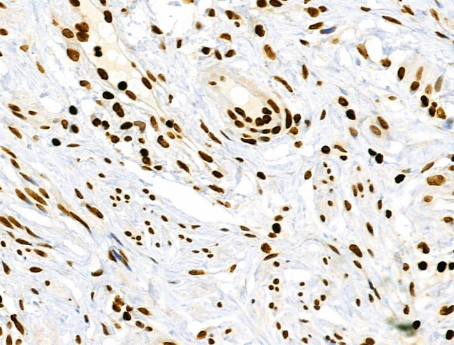 Phospho-RSK Pan (Ser221, Ser227, Ser218, Ser232) Antibody in Immunohistochemistry (Paraffin) (IHC (P))