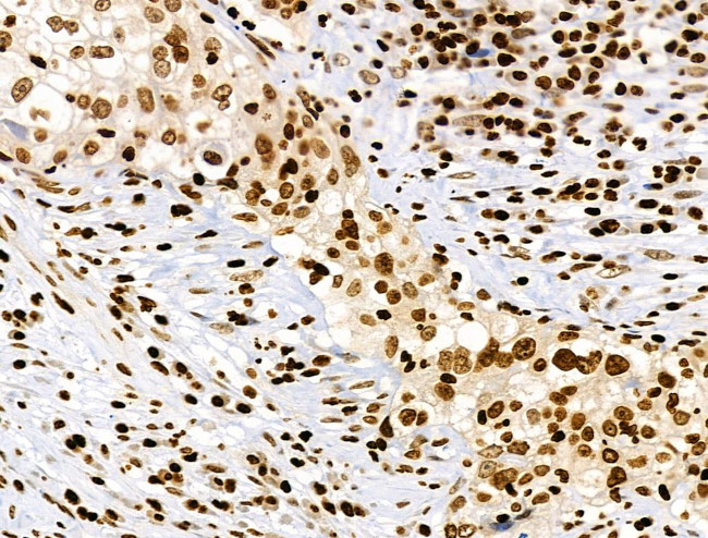 Phospho-RSK Pan (Ser221, Ser227, Ser218, Ser232) Antibody in Immunohistochemistry (Paraffin) (IHC (P))