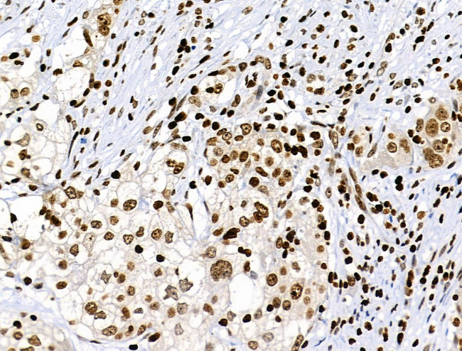 Phospho-RSK Pan (Ser221, Ser227, Ser218, Ser232) Antibody in Immunohistochemistry (Paraffin) (IHC (P))