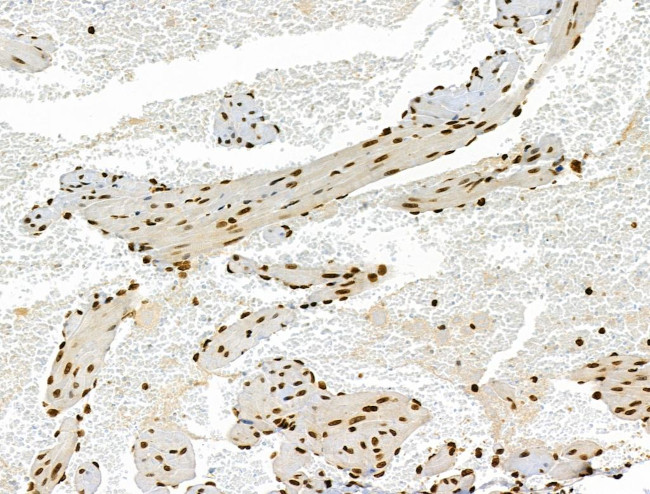 Phospho-RSK Pan (Ser221, Ser227, Ser218, Ser232) Antibody in Immunohistochemistry (Paraffin) (IHC (P))