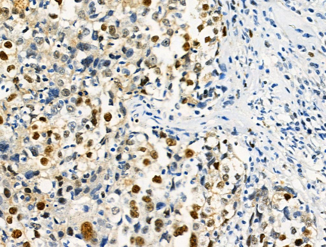 Phospho-SAMHD1 (Thr592) Antibody in Immunohistochemistry (Paraffin) (IHC (P))