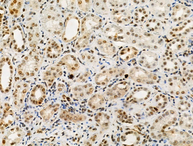 Phospho-SAMHD1 (Thr592) Antibody in Immunohistochemistry (Paraffin) (IHC (P))