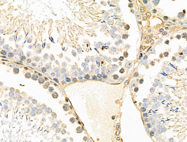 Phospho-SGK2 (Thr253) Antibody in Immunohistochemistry (Paraffin) (IHC (P))