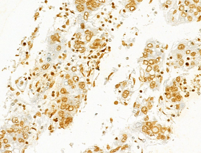 Phospho-SHP2 (Tyr580) Antibody in Immunohistochemistry (Paraffin) (IHC (P))