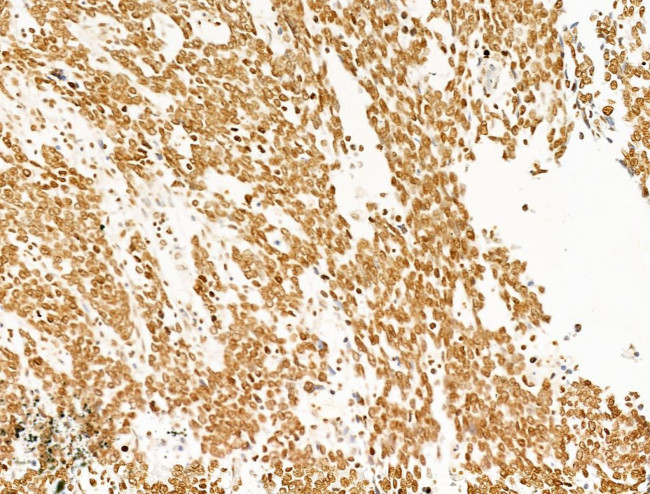 Phospho-SHP2 (Tyr580) Antibody in Immunohistochemistry (Paraffin) (IHC (P))