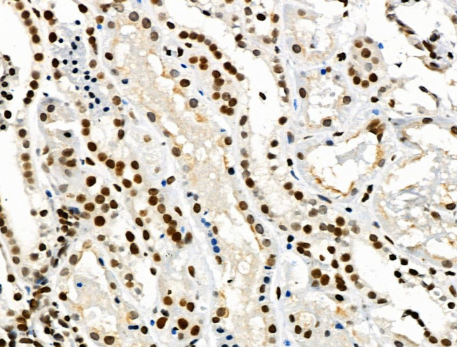 Phospho-SMAD5 (Ser463, Ser465) Antibody in Immunohistochemistry (Paraffin) (IHC (P))