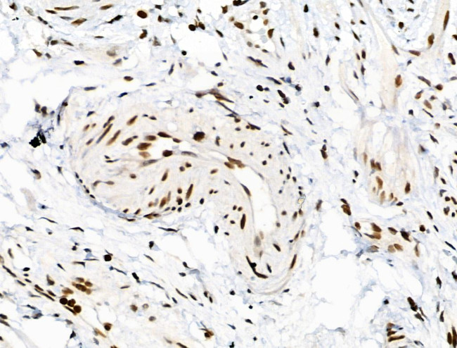 Phospho-SMAD5 (Ser463, Ser465) Antibody in Immunohistochemistry (Paraffin) (IHC (P))