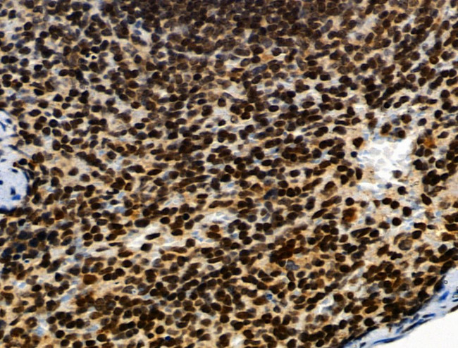 Phospho-SMAD5 (Ser463, Ser465) Antibody in Immunohistochemistry (Paraffin) (IHC (P))