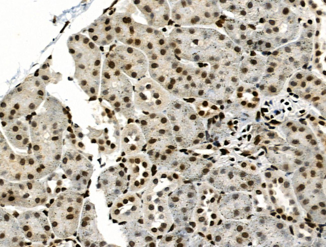 Phospho-SMAD5 (Ser463, Ser465) Antibody in Immunohistochemistry (Paraffin) (IHC (P))