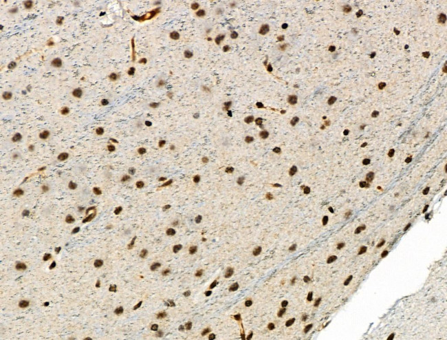 Phospho-SMAD5 (Ser463, Ser465) Antibody in Immunohistochemistry (Paraffin) (IHC (P))