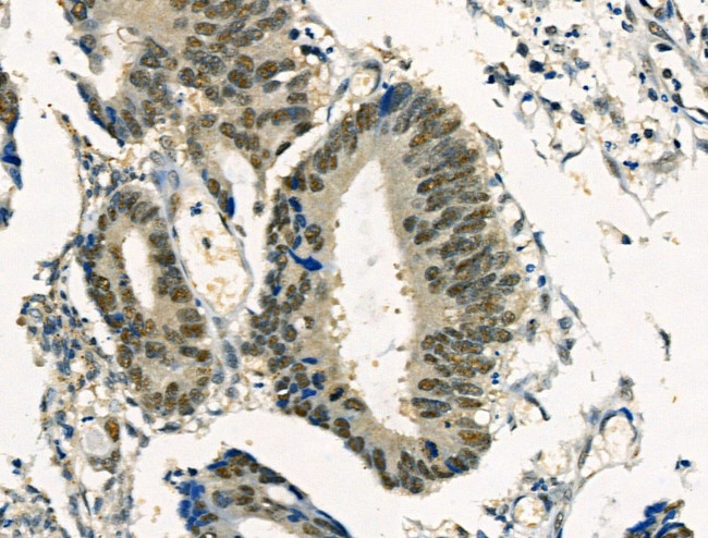 Phospho-SNAIL (Ser11) Antibody in Immunohistochemistry (Paraffin) (IHC (P))