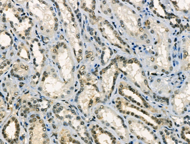 Phospho-SNAIL (Ser11) Antibody in Immunohistochemistry (Paraffin) (IHC (P))