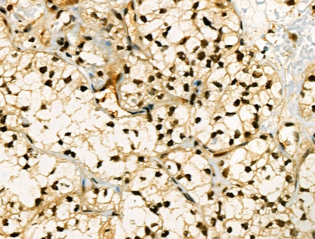 Phospho-SNAIL (Ser11) Antibody in Immunohistochemistry (Paraffin) (IHC (P))