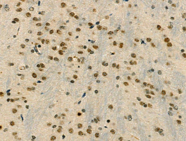 Phospho-SNAIL (Ser11) Antibody in Immunohistochemistry (Paraffin) (IHC (P))