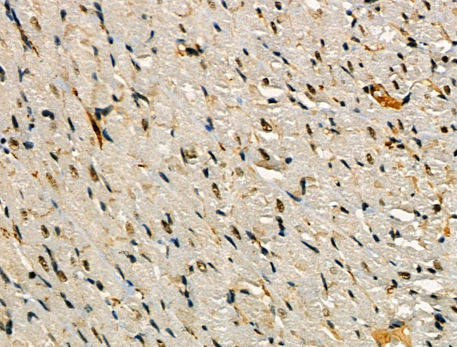 Phospho-SNAIL (Ser11) Antibody in Immunohistochemistry (Paraffin) (IHC (P))