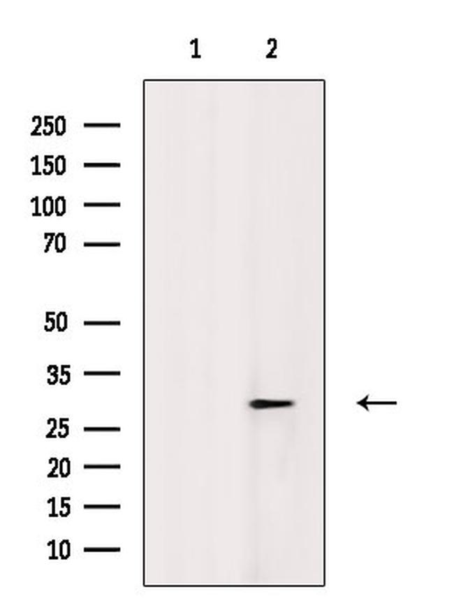 Phospho-SNAIL (Ser11) Antibody in Western Blot (WB)