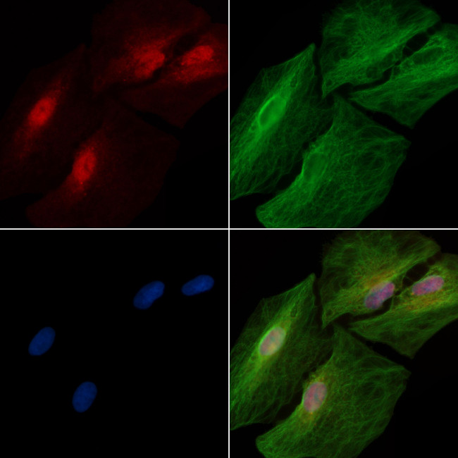 Phospho-STAT2 (Thr387) Antibody in Immunocytochemistry (ICC/IF)