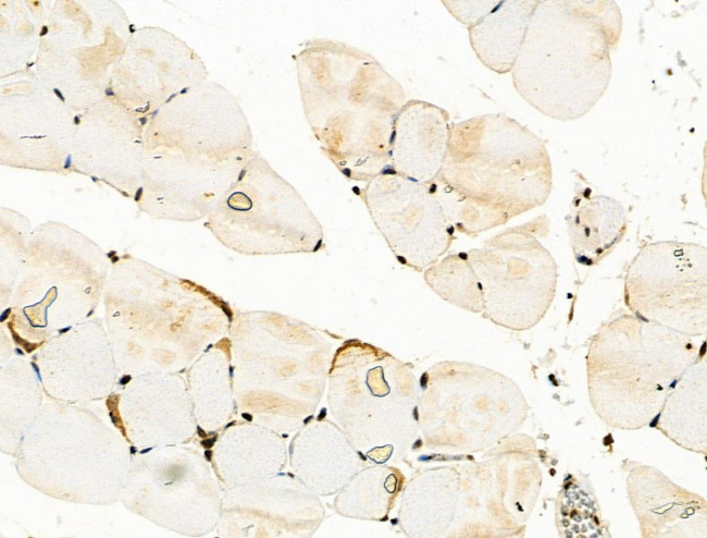 Phospho-STAT2 (Thr387) Antibody in Immunohistochemistry (Paraffin) (IHC (P))