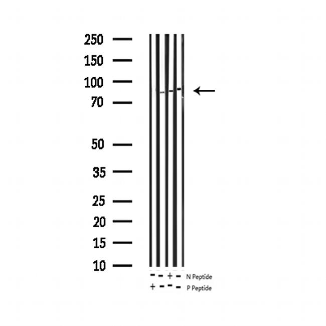 Phospho-STAT5A/B (Tyr694) Antibody in Western Blot (WB)