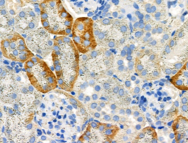 Phospho-TAOK2 (Ser181) Antibody in Immunohistochemistry (Paraffin) (IHC (P))