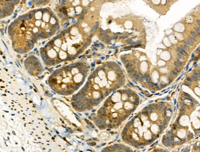 Phospho-TAOK2 (Ser181) Antibody in Immunohistochemistry (Paraffin) (IHC (P))