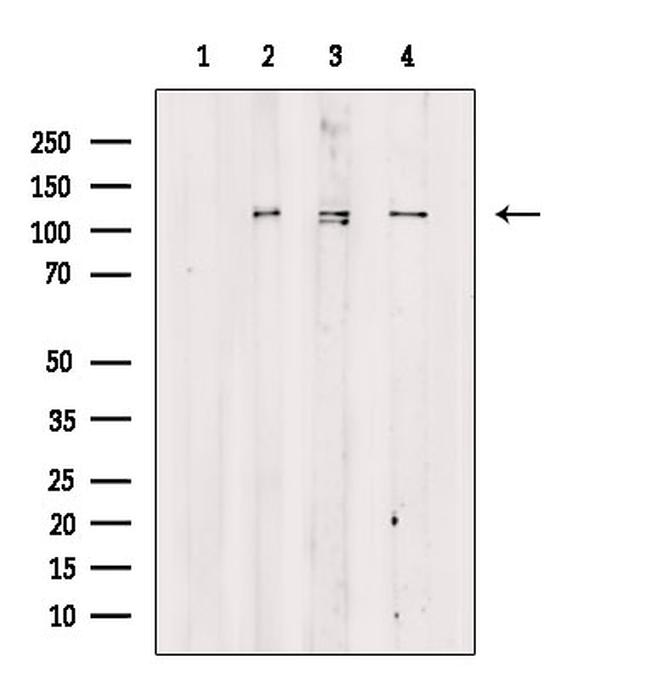 Phospho-TAOK2 (Ser181) Antibody in Western Blot (WB)