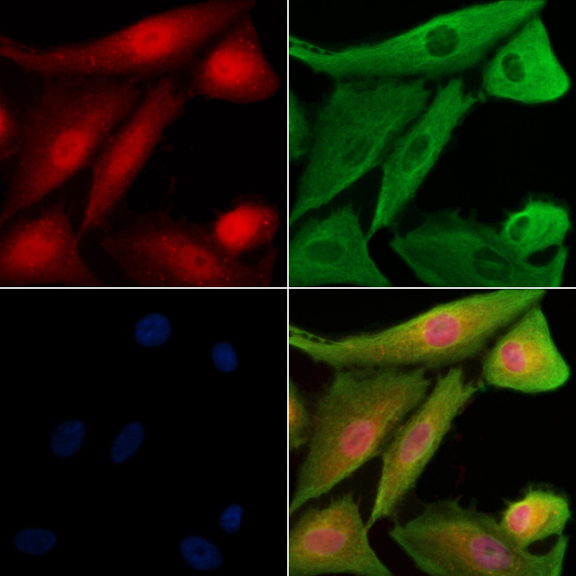 Phospho-TAOK2 (Ser181) Antibody in Immunocytochemistry (ICC/IF)