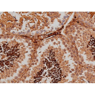 Phospho-Tau (Ser579) Antibody in Immunohistochemistry (Paraffin) (IHC (P))