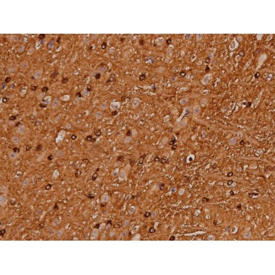 Phospho-Tau (Ser579) Antibody in Immunohistochemistry (Paraffin) (IHC (P))