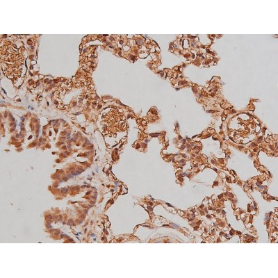 Phospho-Tau (Ser579) Antibody in Immunohistochemistry (Paraffin) (IHC (P))