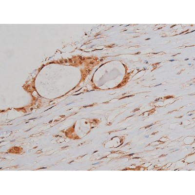 Phospho-Tau (Ser579) Antibody in Immunohistochemistry (Paraffin) (IHC (P))