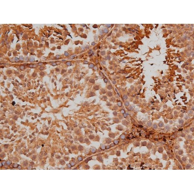 Phospho-Tau (Ser579) Antibody in Immunohistochemistry (Paraffin) (IHC (P))